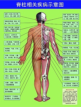 脊柱相关疾病示意图
