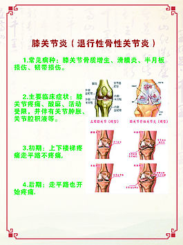 膝关节炎