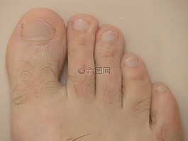 脚,坏,身体的一部分