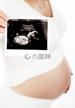 婴儿,肚皮,身体