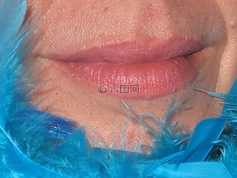 嘴里,嘴唇,面对