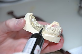 zahntechnik,塑料,假体