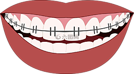 牙齿矫正,微笑,牙齿