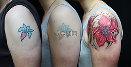 纹身,激光脱毛,激光