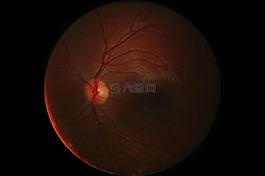 数码摄影视网膜,眼球,数字
