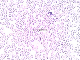 血液,嗜中性白细胞,分段的中性粒细胞