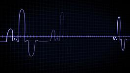 高科技仪表检测心脏速率显示器医疗