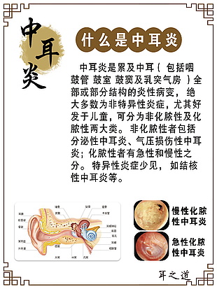 中耳炎科普展板设计