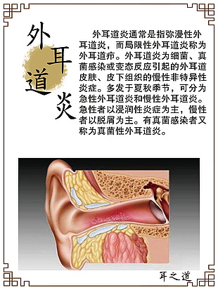外耳道炎科普展板下载